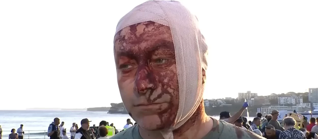 Činjenice i lažne zastave | napad na Židove u Australiji | VIDEO